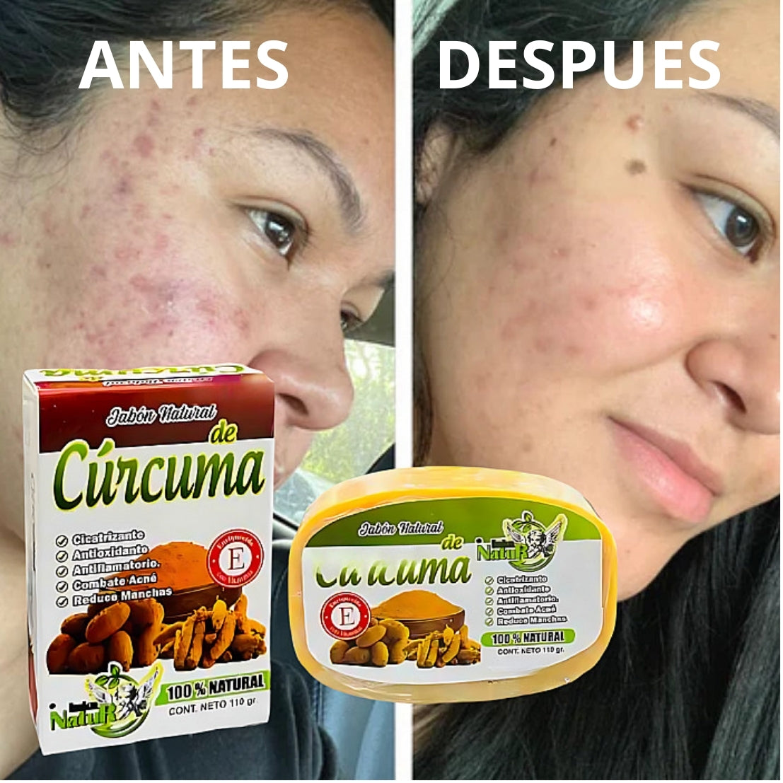 Pack 3 Cúrcuma + 10 mascarrillas